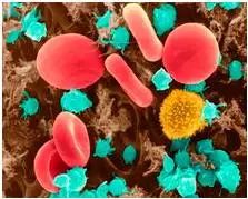 Cancer cell：揭示肿瘤诊断新方法，基于血小板的RNA测序