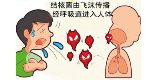 结核病已成为危害我国人民健康最严重的传染病