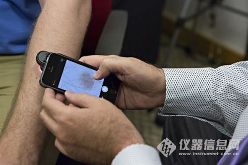 只需500美元 手机APP能检测皮肤癌