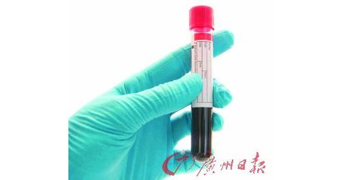 血检可迅速诊断抑郁症