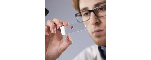 Transl Psychiat：新血液测试可帮助诊断抑郁症