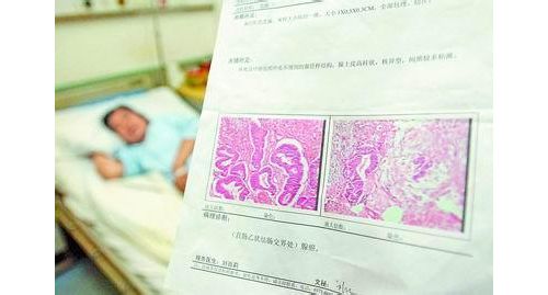 病理诊断常被误解的那些事儿
