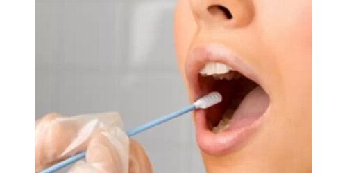 利用唾液来检测肺癌突变，无创、高效、快速！