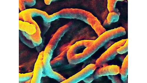 Science：埃博拉病毒变异没有人们想象的那么快
