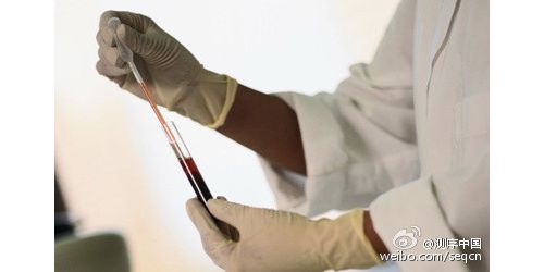 除了BRCA1/2，乳腺癌还有哪些常见突变？