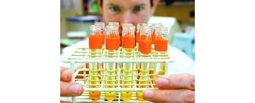 尿液蛋白检测：胰腺癌早期检测的新曙光