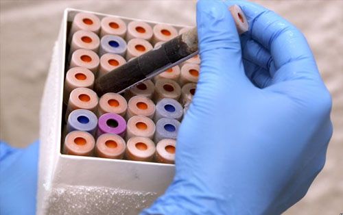 癌症血液检测首次在临床中起作用，有望四年内纳入英国医保