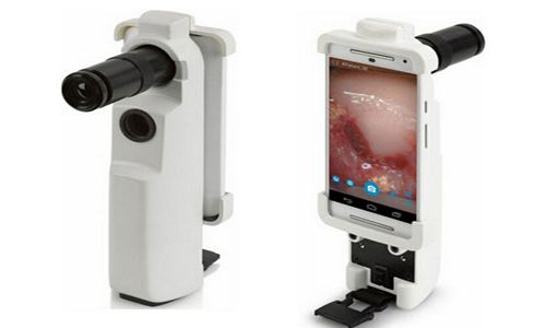 MobileODT用3D打印开发便携式宫颈癌检测装置