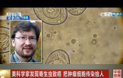 美科学家发现寄生虫致癌 把肿瘤细胞传染给人