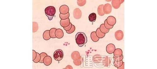 FISH检测在血液肿瘤分子诊断中的全面应用方案