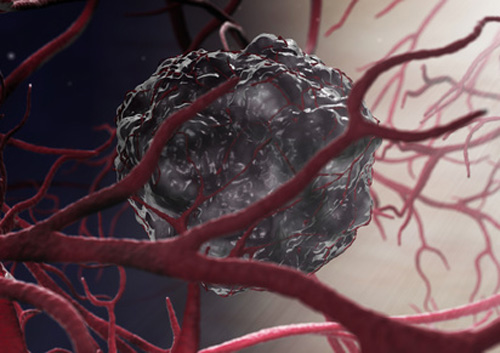 Sci Transl Med：是谁控制着肿瘤转移？