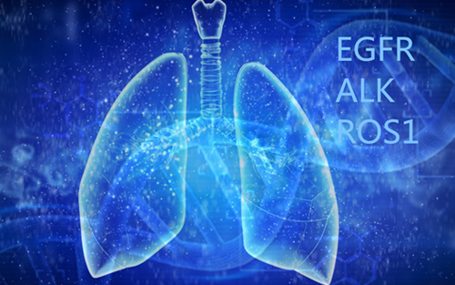 倾听肺癌临床新诉求：EGFR/ALK/ROS1(EAR)同步检测（技术篇）