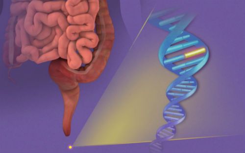 【NEJM】癌症筛查与发病率/死亡率到底有多大关系？