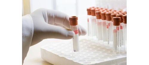体外诊断（IVD）行业分析报告