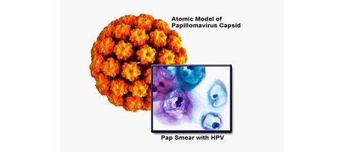 宫颈癌的诊断方法：液基细胞学检查＆HPV检查