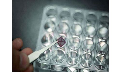 检测心脏病疾患的新方法