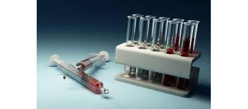 55种检验方法简单解读