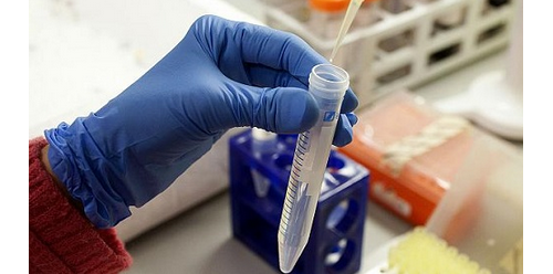 日本科学家发现线粒体病的早期诊断方法