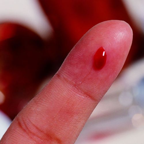 诊断胰腺癌，或许只需一滴血