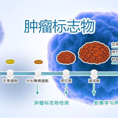 再认识“骇人”的肿瘤标志物检测
