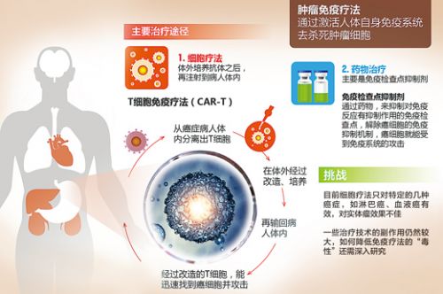 一文读懂前沿科技肿瘤免疫疗法