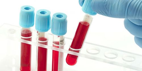 多位专家指导：如何提取和研究血液DNA，RNA与蛋白