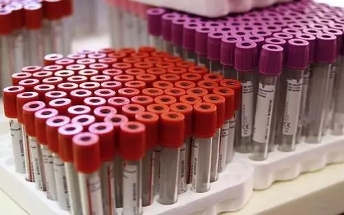 独立医学实验室：由单一实验室变为区域合作模式，鹿死谁手尚不明朗