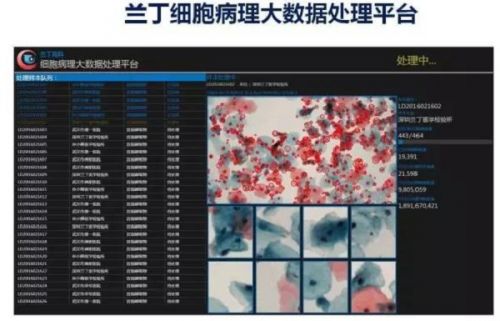 武汉兰丁获数千万融资，未来三年将在全国主要省会城市设立第三方病理诊断中心