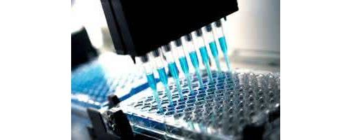 IVD产业并购加剧 市场垄断巨头已露“尖尖角”