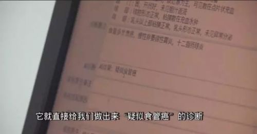 腾讯出了一款AI产品，着眼早期食道癌筛查