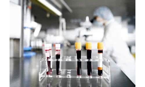欧美专家研发血液筛检癌症新方法