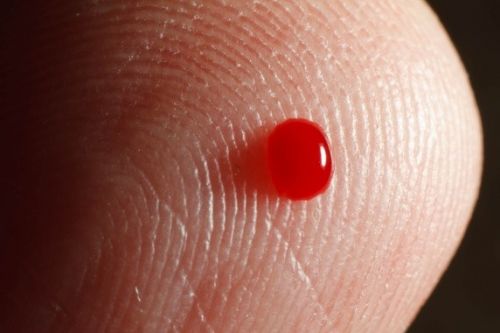 一滴血验出13种癌症：日本开发诊断癌症新方法