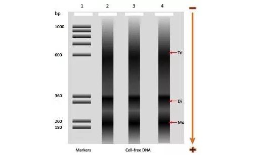循环DNA：分子大小也能作诊断依据