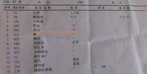 尿常规中的蛋白+怎么回事？看完此文就懂了