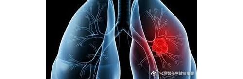 癌症精准治疗时代 _先基因检测后投药治疗