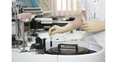Anal. Methods：新型血液检测技术可用于诊断多发性硬化
