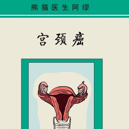 宫颈癌筛查，TCT和HPV哪个更靠谱？