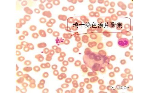 血细胞复检规则解读及相关问题探讨