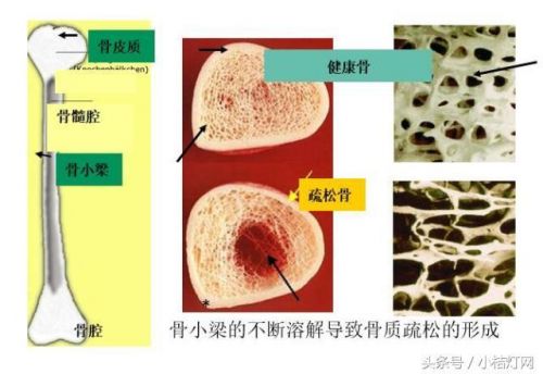IVD知识文库系列-（8.11）生化の骨代谢