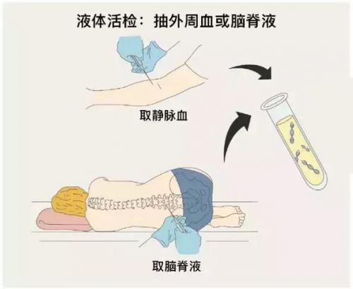 捉妖记：肿瘤靶向药物耐药基因突变什么时候出现？