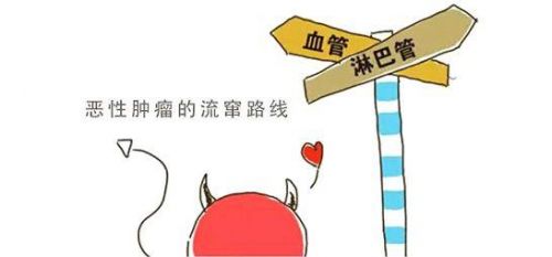 癌症十万个为什么｜如何正确看待肿瘤细胞的转移？