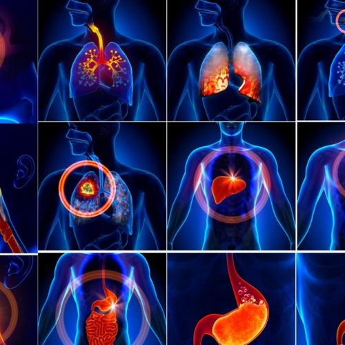 心、肝、肠、肺、肾，这些最重要的人体器官更换需要多少钱？