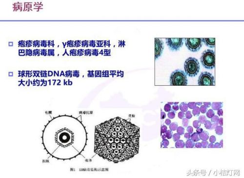 IVD知识文库系列-9.7免疫知识のEB病毒