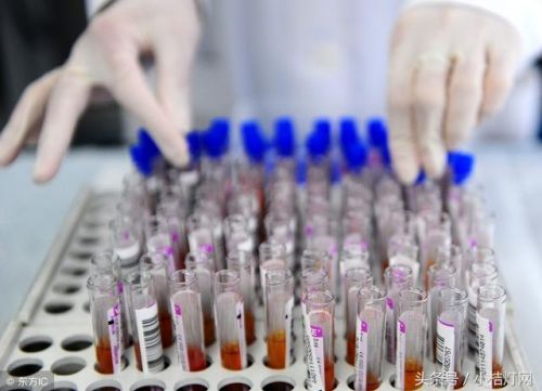 IVD知识文库系列-10.4流式细胞法の白血病残留病灶检测