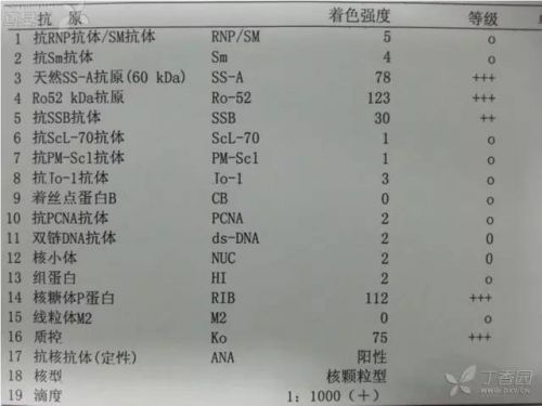 史上最全：自身抗体及其临床意义