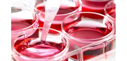 【杂谈】分析前质量因素对尿培养结果及临床诊断准确性的影响 —文献复习