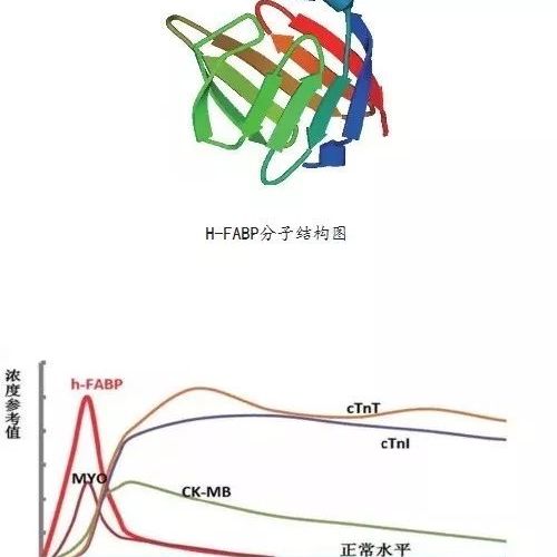 心型脂肪酸结合蛋白（H-FABP） 心梗早期诊断的慧眼指标