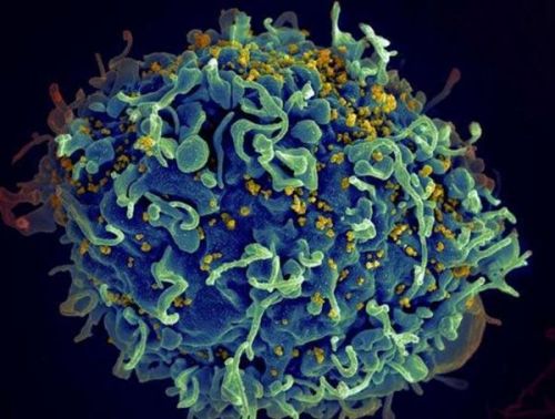 eLife：深入解读“激活并杀死”手段如何有效消除HIV