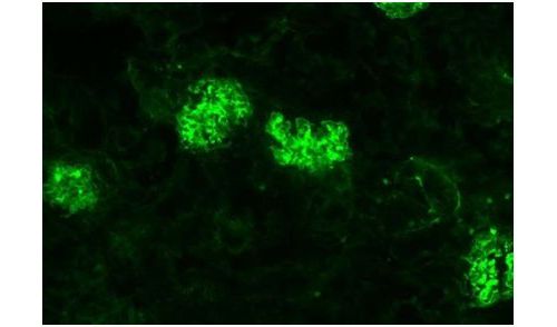Science：细胞毒性T细胞竟让自身免疫疾病更加严重！
