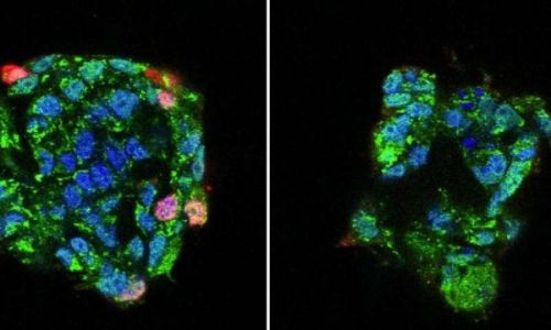 Cell Host & Microbe：震惊！钙离子通道蛋白竟然是甲流病毒感染细胞的关键受体